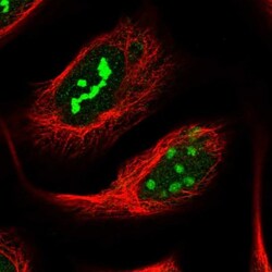 NOP14 Antibody, Novus Biologicals 0.1mL; Unlabeled:Antibodies, Polyclonal